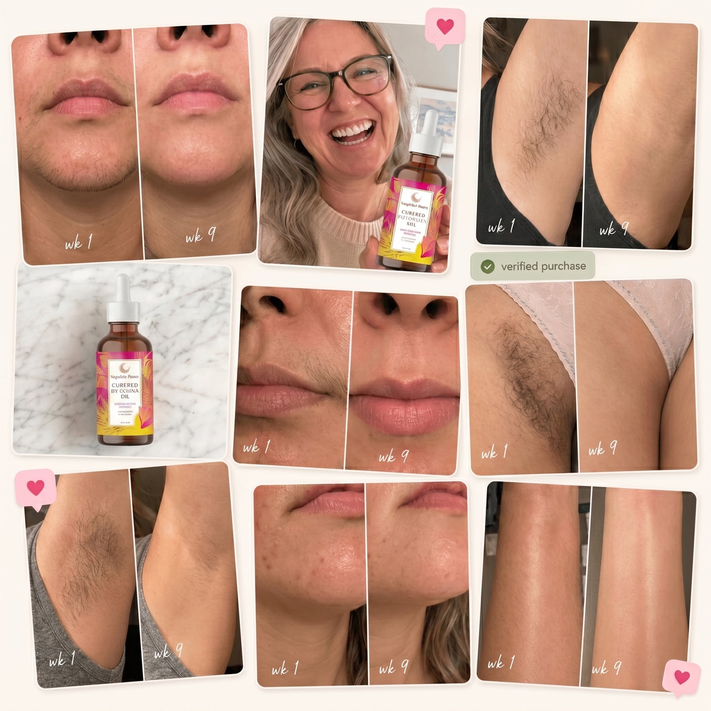 MagicElixir™ Anti-Hair Growth Oil