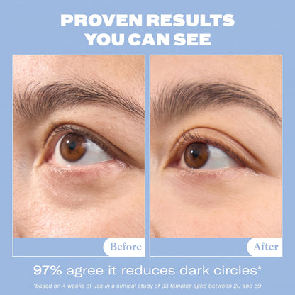 MagicElixir™ Snail Mucin Eye Cream for Under Eye Hollowness & Fine Lines