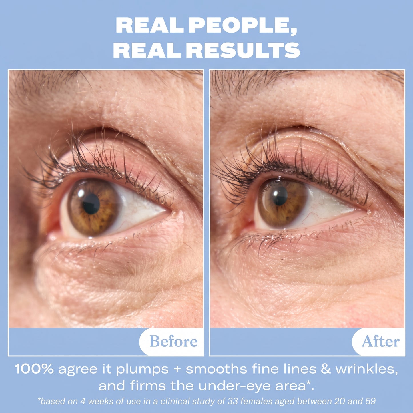 MagicElixir™ Snail Mucin Eye Cream for Under Eye Hollowness & Fine Lines