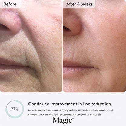 Micro-Infusion Anti Wrinkle Patches