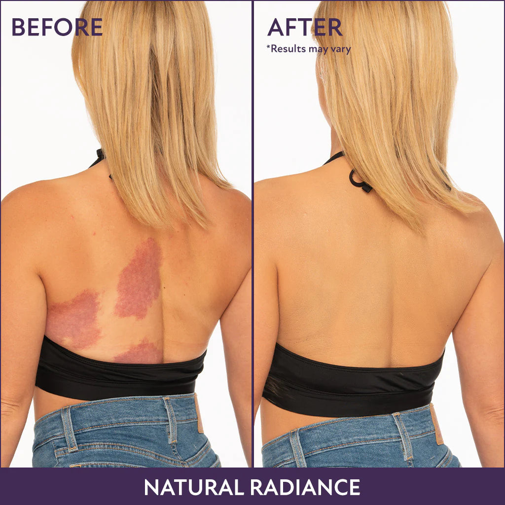 MagicElixir™ Body Coverage
