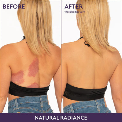 MagicElixir™ Body Coverage