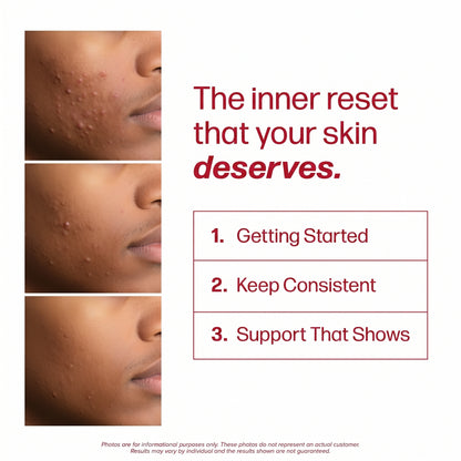 MagicElixir™ Clear Skin Capsules