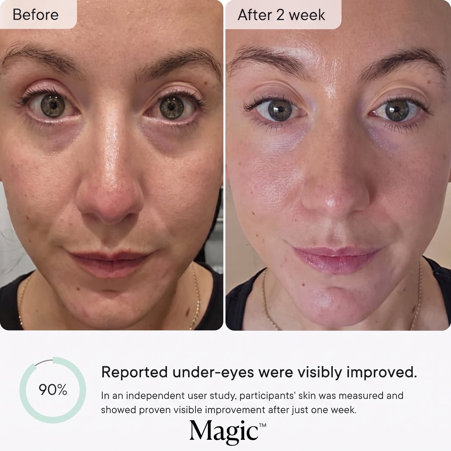 Micro-Infusion Anti Wrinkle Patches
